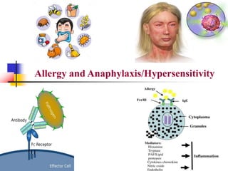 Allergy and Anaphylaxis/Hypersensitivity
1
 