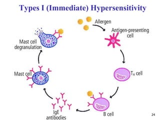 Types I (Immediate) Hypersensitivity
24
 