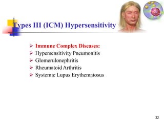 Types III (ICM) Hypersensitivity
32
 Immune Complex Diseases:
 Hypersensitivity Pneumonitis
 Glomerulonephritis
 Rheumatoid Arthritis
 Systemic Lupus Erythematosus
 