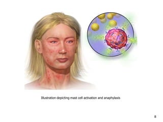 Illustration depicting mast cell activation and anaphylaxis
8
 