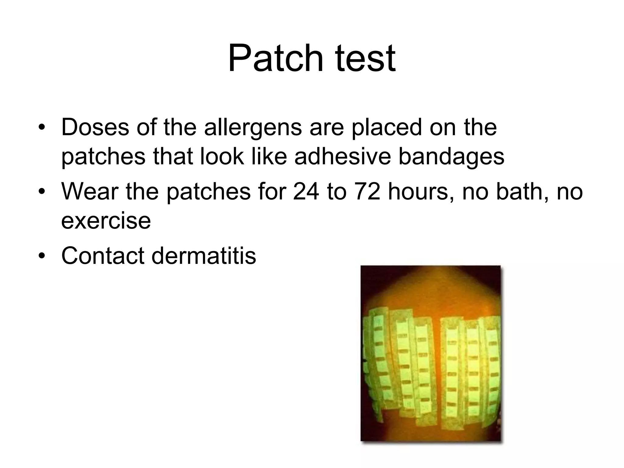allergy tests.pptx