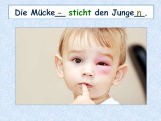 Die Mücke__ sticht den Junge__.- n
 