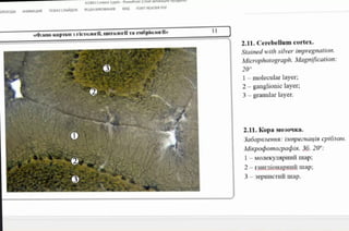 EPEXONS AHMALD6 nOKAJ CIAMROB PELUEH3MPOBAHME BM FOXIT READER POF
pIeuI-kaprku3 ricTaorii, uITOOr Ta evõpio1or»
2.11. Cerebellum cortex.
Stained with silver impregnation.
Microphotograph. Magnification:
20
I-molecular layer:
2-ganglionic layer:
3-granularlayer.
2.11. Kopa Mo301ka.
3aóapaienHS: iMnpezHayis cpió0M.
Mixpopomoepapin. 36. 20":
1-MOIeKynapaniimap;
2-raHtioHapHniimap
3-3epnCTHiI map.
 