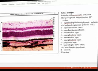 K3SM3 Content Jpptx PowerPoint (Cbot axTeauM npojycta)
nEPEXONH AHMALIMR nOKA3 CIAMAOB PELIEH3POBAHME BA FOXT READER PDF
Retina at night.
Stained with haematoxylin and eosin.
Microphotograph. Magnification: 40
Dem-KapTkH 3 ricraoril, urrooril Ta ewöpioori»
I- retina:
1-pigmental epithelium (pigment-melanin
is in bodies of pigmented epithelial cells);
2-layerof rods and cones;
3-outerlimitingmembrane;
4-outernuclear layer;
5- outer plexiform layer;
6-inner nuclear layer;
7-inner plexiform layer;
8 ganglionic layer;
9-layerofoptie nerve fibers;
10- inner limiting membrane;
II-choroid;
II - sclera.
3METN rE -
 