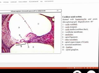 H nEPEXOIH AHMALIMR nOKA3 CAMIOB PEUEH3MPOBAHOME BA FOxT READER POF
-KapIk 3icraorii, UTOOriï Ta ewópio10r i»
Cochlear axial section.
Stained with haematoxylin and eosin.
Microphotograph. Magnification: 40
1-scala vestibuli:
2-scalatympani;
scala media (cochlear duct);
4 vestibular membrane;
5-modiolus:
6-spiral ligament;
7-stria vascularis:
8-spiral organ (organ ofCorti);
9-tectorial membrane;
10-lymbus
11-spiralganglion.
2
3AMETK eMEAR 7
 