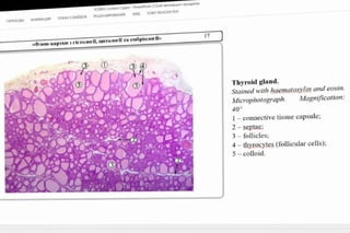 C o n i e n t
3.Ppo
Roweihount
tc.oOW RTAa npoyca
EPEXODM
AMALIMR nOKA3 CIAMDOB
PELEH3WPOBAHIE
B1 FO0T READER PDF
17
pIe-KapTkn
3iCTa0rl, 10rToIOI TA eMopio.loM
Thyroid gland.
Stained with haematoxylin and eosin.
Microphotograph. Magnification:
40*
-connective tissue capsule
2-septae
follicles:
4-thyrocytes (follicular cells):
5- colloid.
 
