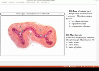 nEPEXOM AHMALWR nOKA3 CAAAOB PELIEHOMPOBAHE BM FOXIT READER PDF
2.03. Bena M'u3oBOro THIy.
3aóapazena 2eMamokcuainom
eounaM. Mixpopomoepapia.
40
I-BHyTpiunso601oHKa;
2-cepeaHAO0O1OHKa
3-aBeHTIHLIÍHaO00/10HKa.
em- kapIk 3 rierAOrI, urro0ril Ta eQpia1orîo
36.:
2.03. Muscular vein.
Stained with haematoxylin and eosin.
Microphotograph. Magnification: 40"
1- tunica intima;
2-tunica media;
3- tunica adventitia.
3METK vEw E* 7 -
 