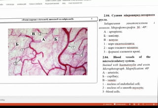AH
nEPEXO AHMALIMR noKA3 CIAIOB PEUEHMPOBAHME BM FOxXT READER POF
2.04. Cyuun mixpounpky.i9Topnoro
«Pem-kaprkat 3 rieTaoril, urrooril Ta eöploOri»
pyc1a.
3a6aparenna 2eNamOKCLiinoM
eounaM.
Minpopomoepapia. 36.: 40
A-apTepiona;
b- kaiIAp
B
A B-BeHya:
I-sapoeHaOTeiiouiITa;
2-npornaIkoro MiouITa;
3-bopMeni eneMenTH KpOBÍ.
2.04. Blood vessels of the
microcirculatory system.
Stained with haematoxylin and eosin.
Microphotograph. Magnification: 40"
A-arteriole;
B-capillary;
B-venule:
1- nucleus of endothelial cell:
2-nucleus ofasmooth myocyte:
3-bloodcells.
 