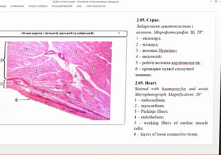 KASM LOtent sppts- oweroint (boM a T nnpoyera
KOAb AHMALR noKACAOB PELIEH3MIPOBAHIE BA FOXIT READER PDF
2.05. Cepue.
3aóapaienHa 2eNamOKcuiinom i
eounon. Mixpopomo:papin. 36. 20":
1-enzokapa:
2-Miokapa
3-BOIOKHaIIypkinse;
4-CHIOTeni;
1e-Kapncn3rhero ril, rraoril Ta enóplomrf
S-po6oui BO1OKHaKapniomiouuriB;
6 1ipomapku nyxkoï cnonyuHoi
TKaHHn.
6
2.05. Heart.
Stained with haematoxylin and eosin.
Microphotograph. Magnification:20
I-
endocardium;
2-myocardium;
3-Purkinjefibers;
4- endothelium;
working fibers of cardiac muscle
cells;
5
6-layersoflooseconnective tissue.
 