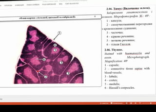 H n E P E X O M A H M A L D OKAJ CIANAO8 PELEH3MPOBAHME BA ONT READER PDF
2.06. THMye (BuzonKOBa 3A.103a).
SaóapaneHHR eMamoKCuiinOM
Jeosuno. Minpopomoepadia. 30.: 40:
I-Kaicy1a;
DIel-kapTkE 3 EieTa0ril, UTOOr Ta enópio10r»
2-CIToyuHOTKAHHHHIIeperopoikH
3 KpOBOHOCHIMI CYUIHaMI;
3 1aCToYka;
4-KipkoBa peyoBilHa;
MO3KOBa pevoBIIHa;
6- TiTbIIH Laccais.
2.06. Thymus.
Stained with haemataxylin and
eosin. Microphotograph.
6 Magnification: 40
I-capsule;
2 connective tissue septae with
blood vessels;
3-lobule;
4-cortex;
5-medulla;
6-Hassall's corpuscles.
3AMETO MEM 7
 