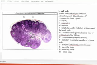 AMAPH nEPEXOM AHMALLAIR nOKA3CIARnOB PELUEHIMPOBAHVE BMA FONIT READER POF
Lymph node.
Staimed with haematoxylin and eosin.
a p c u 3 rieTO,riI, I0rroorif Ta eMÓpia or f»
Microphotograph. Magnification: 40
I- connective tissue capsule;
2-cortex
3-paracortex
4 medulla;
5-lymphatic nodules (follicles) in the cortex of
the lymph node;
5.1- reactive center (germinal center, zone of
prolifiration) of the follicle;
5.2-crown of the lymphatic follicle;
6- medullary cords in the medulla ofalymph
6
node:
7-marginal (subeapsular, cortical) sinus;
8-trabecular sinus;
9- medullary sinus;
10- hilum sinus.
xChaiAy
 