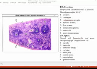 KSM Coent spptx- Pwerroi (cboW acresaun npolyera)
nEPEXO AHMALR nOKAJ CIAAAOB PELEHVIPOBAHIVME BA FOXT READER POF
2.08. Cenesinka.
JaóapaienHS eeNamoxCuniHOM eosuHOM.
Mixpodpomozpapia. 36. 20":
T-Kancyna;
2-Tpaóekya:
KaprkicTariL, UTO Ta enopia0r »
3-TpabexyxpHaaprepia;
4-epBoHa nynbia;
5-6iia nyiba;
6-IIeHTpaibHa aprepix;
7-Me3oreaii:
8-IIeHTppo3MHOKeHHS.
2.08. Spleen.
Stained with haematoxylin and eosin.
Microphotograph. Magnification: 20
I-capsule
2-trabecula;
O
3-trabecular artery;
4-redpulp;
5-whitepulp;
6-central artery;
7-mesothelium;
8-germinal center.
nañny
 