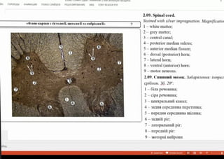 H nEPEXObM AHMAL nOKA3 CIAAOB PELIEHVP08AHME BA FOXOT READER POF
2.09. Spinal cord.
Stained with silver impregnation. Magnificatio
1-whitematter;
2-grey matter;
«em-capnas s ricraor fi, urraorff Ta enQpioor +»
3-centralcanal;
4- posterior median sulcus;
5- anterior median fisure;
6-dorsal (posterior) horn;
7-lateralhorn;
8-ventral (anterior) horn;
9-motorneurons.
2.09. CuunHui MO3OK. 3aóapeienHR: innpez
cpiónon. 36. 20":
I- 61a peuOBiHa;
2-cipapeyoBIHa;
3-1neHTpalbHnikanai,
4-33/1cepeiHHamepeTiHHKa
-IIepeHA CepeuHHaminHa;
6-3a/IHiii pir;
7-1arepalbHni pir;
8-nepeaHii pir:
9-MOTOPHi HeipoHn
y
3AMET
 
