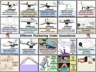 Anesthesia Ramp Position INFOGRAPHICS in ANAESTHESI by Dr. Tushar Chokshi.pptx