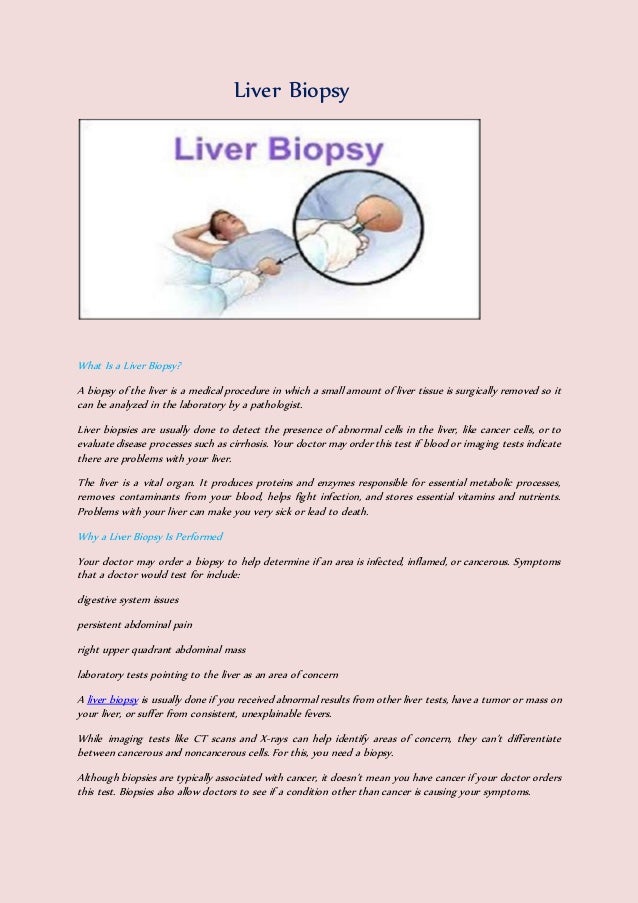 All information abuout liver biopsy