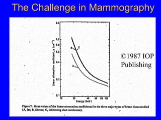 ©1987 IOP
Publishing
The Challenge in Mammography
 
