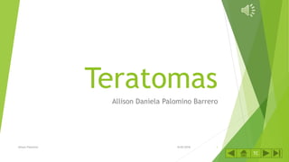Teratomas
Allison Daniela Palomino Barrero
8/05/2018Allison Palomino 1
TC
 