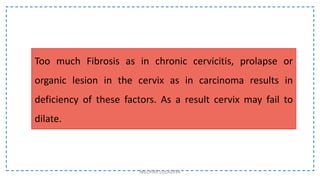 Too much Fibrosis as in chronic cervicitis, prolapse or
organic lesion in the cervix as in carcinoma results in
deficiency of these factors. As a result cervix may fail to
dilate.
NILOFAR LOLADIYA
 