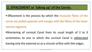  Effacement is the process by which the muscular fibres of the
cervix are pulled upwards and merges with the fibres of the lower
uterine segment.
Shortening of cervical Canal from its usual length of 2 to 3
centimetres to one in which the cervical Canal is obliterated
leaving only the external os as a circular orifice with thin edges.
NILOFAR LOLADIYA
2. EFFACEMENT or ‘taking up’ of the Cervix.
 