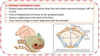 4. INTERNAL ROTATION OF HEAD:
• Occiput leads and meets the pelvic floor first and rotate anteriorly through 1/8th of
a circle
• From Lt Iliopectineal eminence to the symphysis pubis
• Causes a slight twist in the neck of the fetus
• Thus, head no longer in direct alignment with the shoulder
NILOFAR LOLADIYA
 