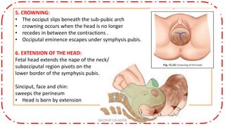 5. CROWNING:
• The occiput slips beneath the sub-pubic arch
• crowning occurs when the head is no longer
• recedes in between the contractions .
• Occiputal eminence escapes under symphysis pubis.
6. EXTENSION OF THE HEAD:
Fetal head extends the nape of the neck/
subocciputal region pivots on the
lower border of the symphysis pubis.
Sinciput, face and chin:
sweeps the perineum
• Head is born by extension
NILOFAR LOLADIYA
 