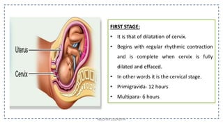 FIRST STAGE:
• It is that of dilatation of cervix.
• Begins with regular rhythmic contraction
and is complete when cervix is fully
dilated and effaced.
• In other words it is the cervical stage.
• Primigravida- 12 hours
• Multipara- 6 hours
NILOFAR LOLADIYA
 