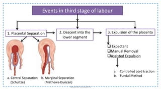 Events in third stage of labour
NILOFAR LOLADIYA
1. Placental Separation
a. Central Separation
(Schultze)
2. Descent into the
lower segment
3. Expulsion of the placenta
 Expectant
Manual Removal
Assisted Expulsion
b. Marginal Separation
(Mathews-Duncan)
a. Controlled cord traction
b. Fundal Method
 