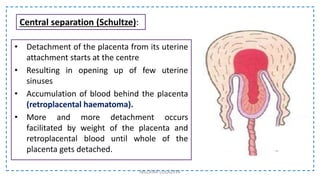 • Detachment of the placenta from its uterine
attachment starts at the centre
• Resulting in opening up of few uterine
sinuses
• Accumulation of blood behind the placenta
(retroplacental haematoma).
• More and more detachment occurs
facilitated by weight of the placenta and
retroplacental blood until whole of the
placenta gets detached.
NILOFAR LOLADIYA
Central separation (Schultze):
 