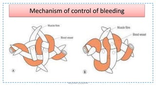 NILOFAR LOLADIYA
Mechanism of control of bleeding
 