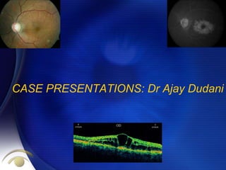 CASE PRESENTATIONS: Dr Ajay Dudani
 