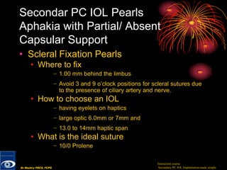 Instruction course-Secondary posterior chamber IOL (PC IOL ...
