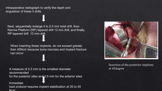 Insertion of the posterior implants
at 45degree
intraoperative radiograph to verify the depth and
angulation of these 4 drills.
Next, sequentially enlarge it to 2.0 mm twist drill, then
Narrow Platform (NP) tapered drill 13 mm drill, and finally,
RP tapered drill 13 mm drill.
When inserting these implants, do not exceed greater
than 45Ncm because bone necrosis and implant fracture
can occur
A measure of 4.3 mm is the smallest diameter
recommended
for the posterior sites and 3.5 mm for the anterior sites
Immediate
load protocol requires implant stabilization at 35 to 45
 