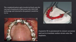The completed pattern gets transferred back onto the
cast and a framework is fabricated with CAD/CAM
technology and returned to the patient’s mouth for
try-in.
A passive fit is paramount to ensure accuracy
and not to translate undue strain onto the
implants.
 