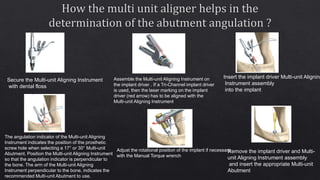 Secure the Multi-unit Aligning Instrument
with dental floss
Assemble the Multi-unit Aligning Instrument on
the implant driver . If a Tri-Channel implant driver
is used, then the laser marking on the implant
driver (red arrow) has to be aligned with the
Multi-unit Aligning Instrument
Insert the implant driver Multi-unit Aligning
Instrument assembly
into the implant
The angulation indicator of the Multi-unit Aligning
Instrument indicates the position of the prosthetic
screw hole when selecting a 17° or 30° Multi-unit
Abutment. Position the Multi-unit Aligning Instrument
so that the angulation indicator is perpendicular to
the bone. The arm of the Multi-unit Aligning
Instrument perpendicular to the bone, indicates the
recommended Multi-unit Abutment to use.
Adjust the rotational position of the implant if necessary
with the Manual Torque wrench
Remove the implant driver and Multi-
unit Aligning Instrument assembly
and insert the appropriate Multi-unit
Abutment
 