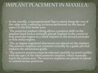  In the maxilla, a mucoperiosteal flap is raised along the rest of
the ridge with 2 relieving incisions performed on the buccal
aspect in the first molar area.
 The posterior implant tilting allows a position shift on the
implant head from a vertically placed implant in the canine or
first premolar region to a tilted implant in the second premolar
or first molar region.
 The 30 degree angulated abutments are placed on the implant,.
The anterior implants are oriented vertically by a guide pin that
replaces the edentulous guide.
 The anterior position must be selected carefully to avoid conflict
with the apex of the tilted posterior implant, which normally
reach the canine area. The anterior implants are placed in lateral
or central incisor positions.
 
