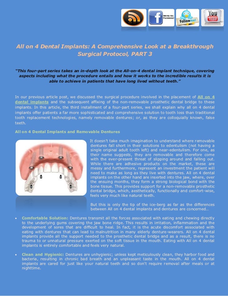 All on 4 dental implants a comprehensive look at a breakthrough surgi…