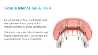 Cosa si intende per All on 4
La tecnica All on four, che tradotto vuol
dire tutto-in-4, è una procedura di
impianto dentale di ultima generazione.
Evita tutta una serie di fastidi relativi agli
impianti dentali mobili, il tutto grazie alle
protesi dentarie fisse a costi ridotti
 