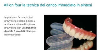 All on four la tecnica del carico immediato in sintesi
In pratica si fa una protesi
provvisoria e dopo 4 mesi si
andrà a sostituire l’impianto
provvisorio con un impianto
dentale fisso definitivo più
bello e preciso.
 