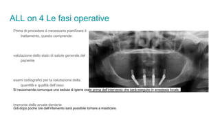 ALL on 4 Le fasi operative
Prima di procedere è necessario pianificare il
trattamento, questo comprende:
valutazione dello stato di salute generale del
paziente
esami radiografici per la valutazione della
quantità e qualità dell’osso
impronte delle arcate dentarie
Si raccomanda comunque una seduta di igiene orale prima dell’intervento che sarà eseguito in anestesia locale.
Già dopo poche ore dall’intervento sarà possibile tornare a masticare.
 