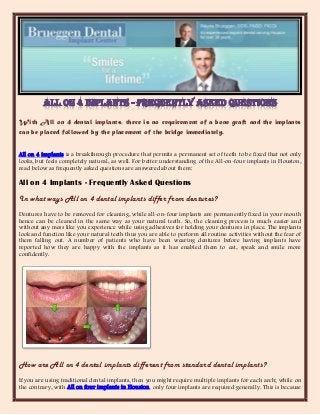 With All on 4 dental implants, there is no requirement of a bone graft and the implants
can be placed followed by the placement of the bridge immediately.


All on 4 implants is a breakthrough procedure that permits a permanent set of teeth to be fixed that not only
looks, but feels completely natural, as well. For better understanding of the All-on-four implants in Houston,
read below as frequently asked questions are answered about them:

All on 4 Implants - Frequently Asked Questions
In what ways All on 4 dental implants differ from dentures?
Dentures have to be removed for cleaning, while all-on-four implants are permanently fixed in your mouth
hence can be cleaned in the same way as your natural teeth. So, the cleaning process is much easier and
without any mess like you experience while using adhesives for holding your dentures in place. The implants
look and function like your natural teeth thus you are able to perform all routine activities without the fear of
them falling out. A number of patients who have been wearing dentures before having implants have
reported how they are happy with the implants as it has enabled them to eat, speak and smile more
confidently.




How are All on 4 dental implants different from standard dental implants?
If you are using traditional dental implants, then you might require multiple implants for each arch; while on
the contrary, with All on four implants in Houston, only four implants are required generally. This is because
 