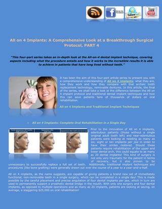 All on 4 Implants: A Comprehensive Look at a Breakthrough Surgical
                          Protocol, PART 4


  “This four-part series takes an in-depth look at the All-on-4 dental implant technique, covering
 aspects including what the procedure entails and how it works to the incredible results it is able
                     to achieve in patients that have long lived without teeth.”




                                      It has been the aim of this four-part article series to present you with
                                      a comprehensive understanding of All on 4 implants; what they are,
                                      how they work and how they compare with that archaic tooth
                                      replacement technology, removable dentures. In this article, the final
                                      of the series, we shall take a look at the difference between the All on
                                      4 implant protocol and traditional dental implant techniques and how
                                      this can save patients tens of thousands of dollars on oral
                                      rehabilitation.

                                      All on 4 Implants and Traditional Implant Techniques




                 All on 4 Implants: Complete Oral Rehabilitation in a Single Day

                                                            Prior to the innovation of All on 4 implants,
                                                             edentulous patients (those without a single
                                                             original adult tooth left) and near-edentulous
                                                             patients were looking at needing as many as
                                                             six, eight or ten implants per jaw in order to
                                                             have their smiles restored. Should these
                                                             patients require rehabilitation of the upper and
                                                            lower dental arch, this could equate to as many
                                                            as 20 dental implants! This kind of surgery is
                                                            not only very traumatic for the patient in terms
                                                             of recovery, but it also proven to be
unnecessary to successfully replace a full set of teeth. Additionally, traditional implant techniques and
procedures (like bone grafting) were generally drawn out over the course of a year to a year-and-a-half.

All on 4 implants, as the name suggests, are capable of giving patients a brand new set of immediately
functional, non-removable teeth in a single surgery, which can be completed in a single day! This is made
possible by the careful placement and precise angulation of four dental implants per jaw, which in turn are
used to permanently support a prosthetic dental bridge in the mouth. With only one surgery and four dental
implants, as opposed to multiple operations and as many as 20 implants, patients are looking at saving, on
average, a staggering $25,000 on oral rehabilitation!
 