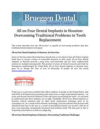 All on Four Dental Implants in Houston:
   Overcoming Traditional Problems in Teeth
                 Replacement
This article describes how the ‘All-on-Four’ is capable of overcoming problems that face
traditional dental implant techniques.

All on Four Dental Implants in Houston: An Overview

Gone are the days when those that have already lost, or are about to lose all of their original
teeth have to accept a future of removable dentures or false teeth. All on Four dental
implants in Houston provide a long term, non-removable and far more sophisticated
solution to multiple missing teeth. The product of years of clinical research and trials by
Portuguese implantologist Dr. Paulo Malo, All on Four dental implants in Houston have
gone on to change the lives of tens of thousands of people all over the world
(www.nodentures.com).




Tooth loss is a pervasive problem that affects millions of people in the United States. And
with 85% of all Americans presenting with some form or stage of periodontal disease – an
acute and chronic bacterial infection of the soft tissue surrounding the teeth – it’s not hard
to understand why these statistics are so high. Thankfully, All on Four dental implants in
Houston achieve solutions that no other teeth replacement technique prior to its
conception can. As a result of this fantastic technology, even the patients that present with
advanced bone loss in the jaw as a result of periodontal disease can receive a full set of
new, non-removable, immediately functional and aesthetic teeth. The best part is; this is
frequently achievable in as little as a single day.

All on Four Dental Implants in Houston: Overcoming Traditional Challenges
 