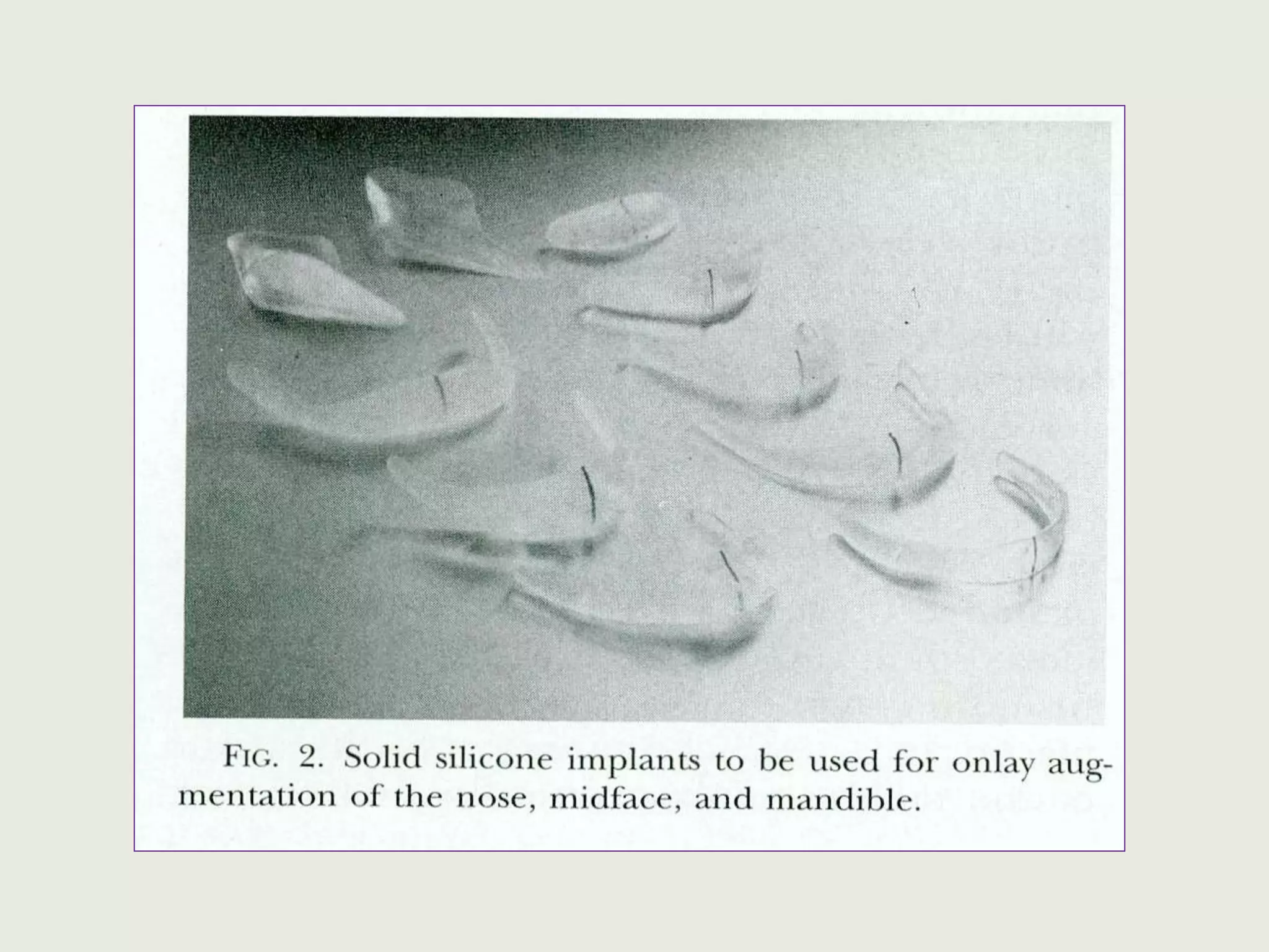 Alloplastic materials | PPTX
