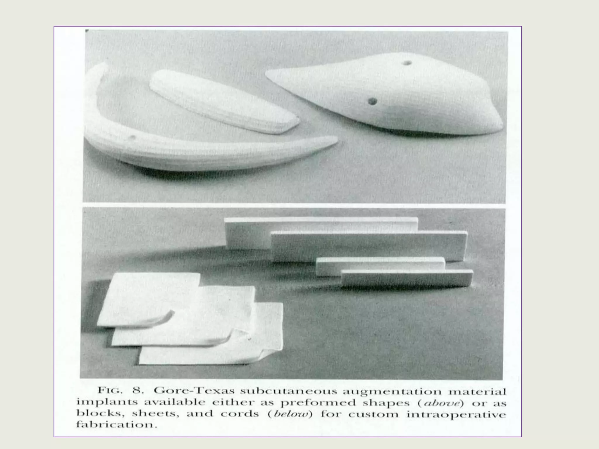 Alloplastic materials | PPTX