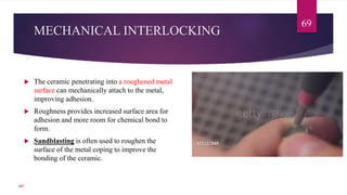 MECHANICAL INTERLOCKING
 The ceramic penetrating into a roughened metal
surface can mechanically attach to the metal,
improving adhesion.
 Roughness provides increased surface area for
adhesion and more room for chemical bond to
form.
 Sandblasting is often used to roughen the
surface of the metal coping to improve the
bonding of the ceramic.
69
107
 