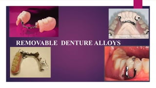 REMOVABLE DENTURE ALLOYS
 