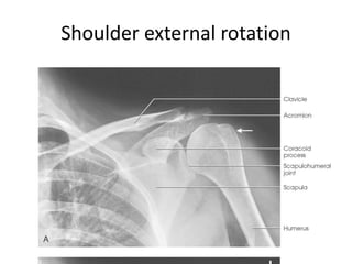 All projections Anatomy | PPTX