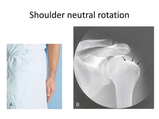 All projections Anatomy | PPTX