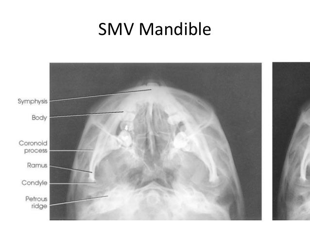 All projections Anatomy