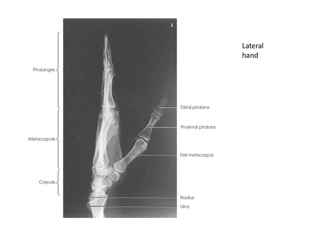 All projections Anatomy